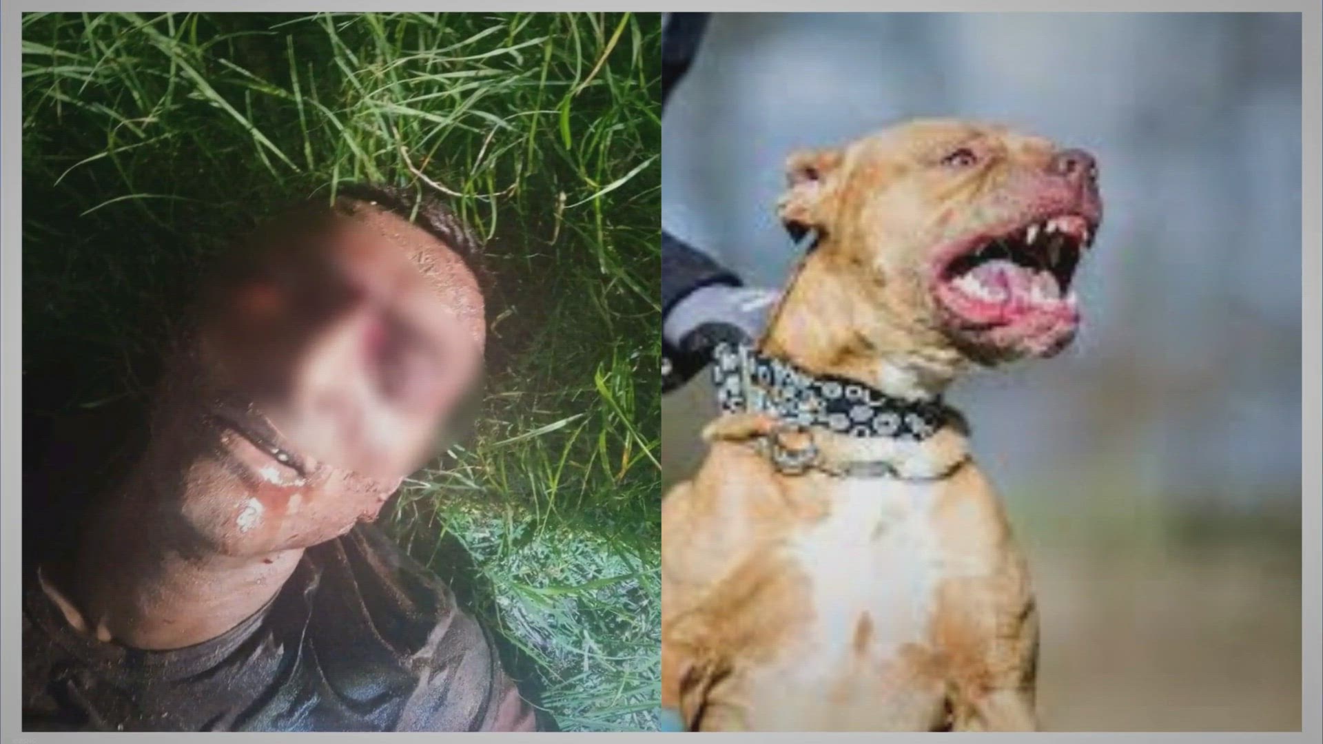 Video thumbnail for Man, 44, Loses Eyeball And Chunks Of Flash In Pitbull Attack