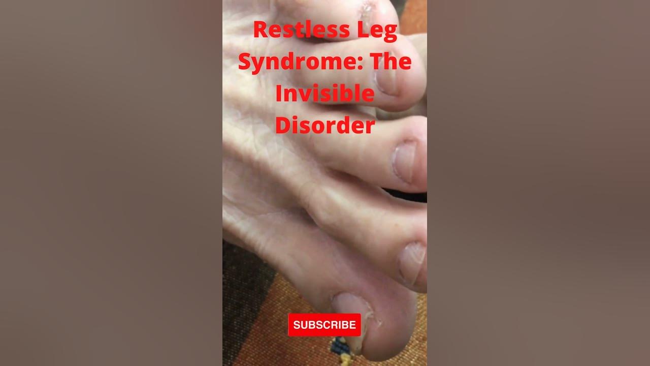 'Video thumbnail for Restless Legs Syndrome: The Invisible Disorder #shorts #restlesslegs'