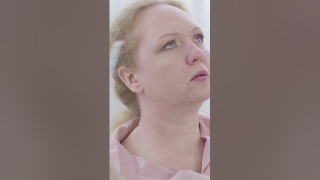 'Video thumbnail for How to Tell if You're One of the Women who Are Likely to Experience Hair Loss #shorts'