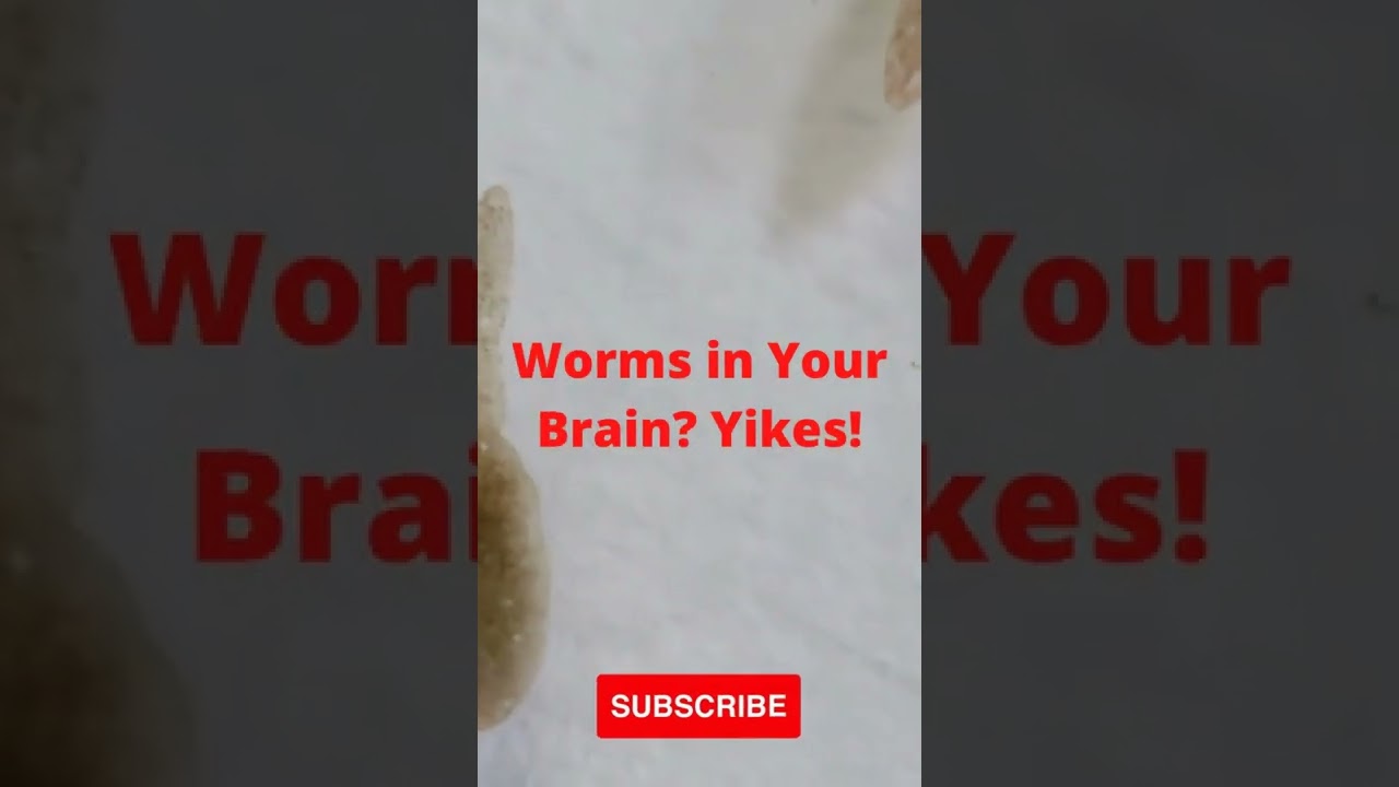 'Video thumbnail for Worms in Your Brain Yikes! #shorts '