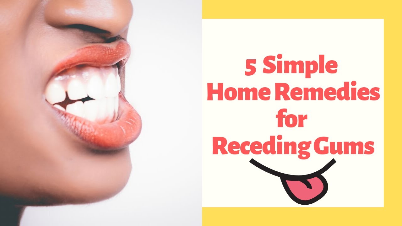 Video thumbnail for 5 Simple Home Remedies for Receding Gums