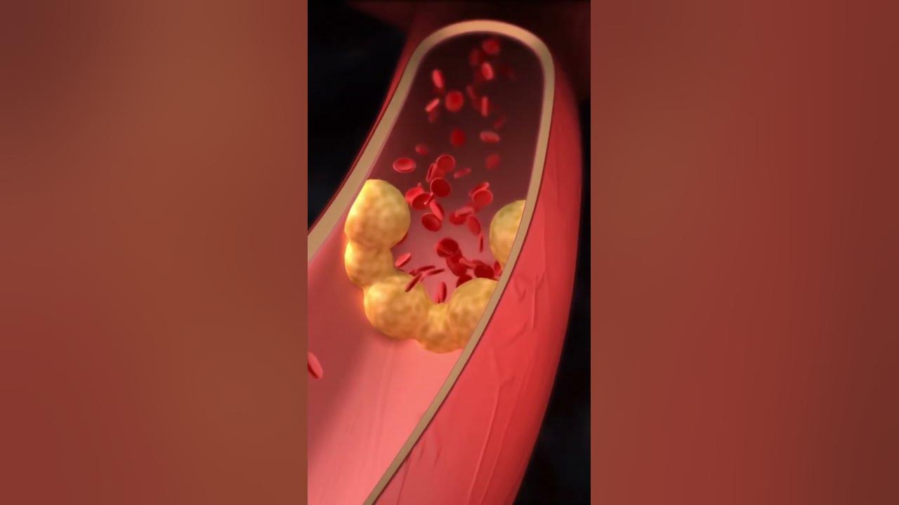 'Video thumbnail for The Surprising Benefits of this Leafy Green for Your Heart #shorts'