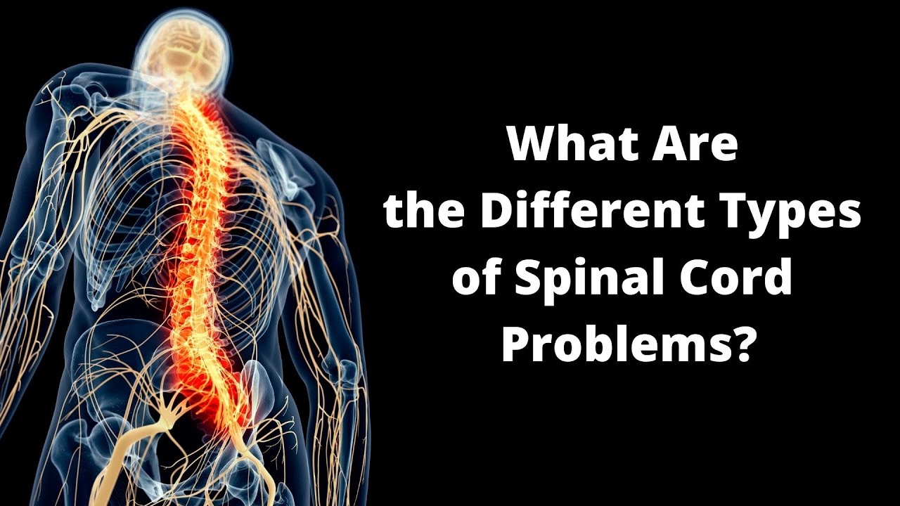 'Video thumbnail for What are the different types of spinal cord problems?'