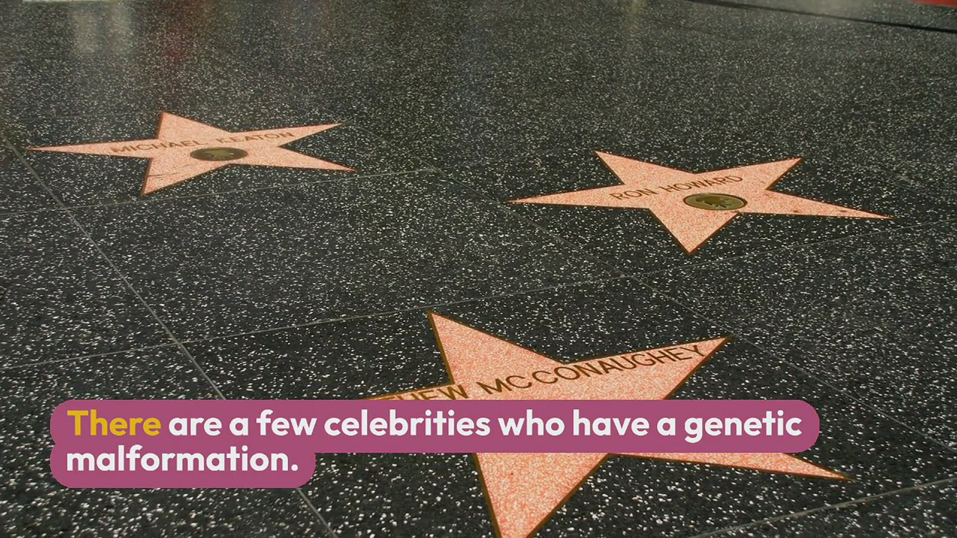 Video thumbnail for Is there a celebrity who has a genetic malformation?