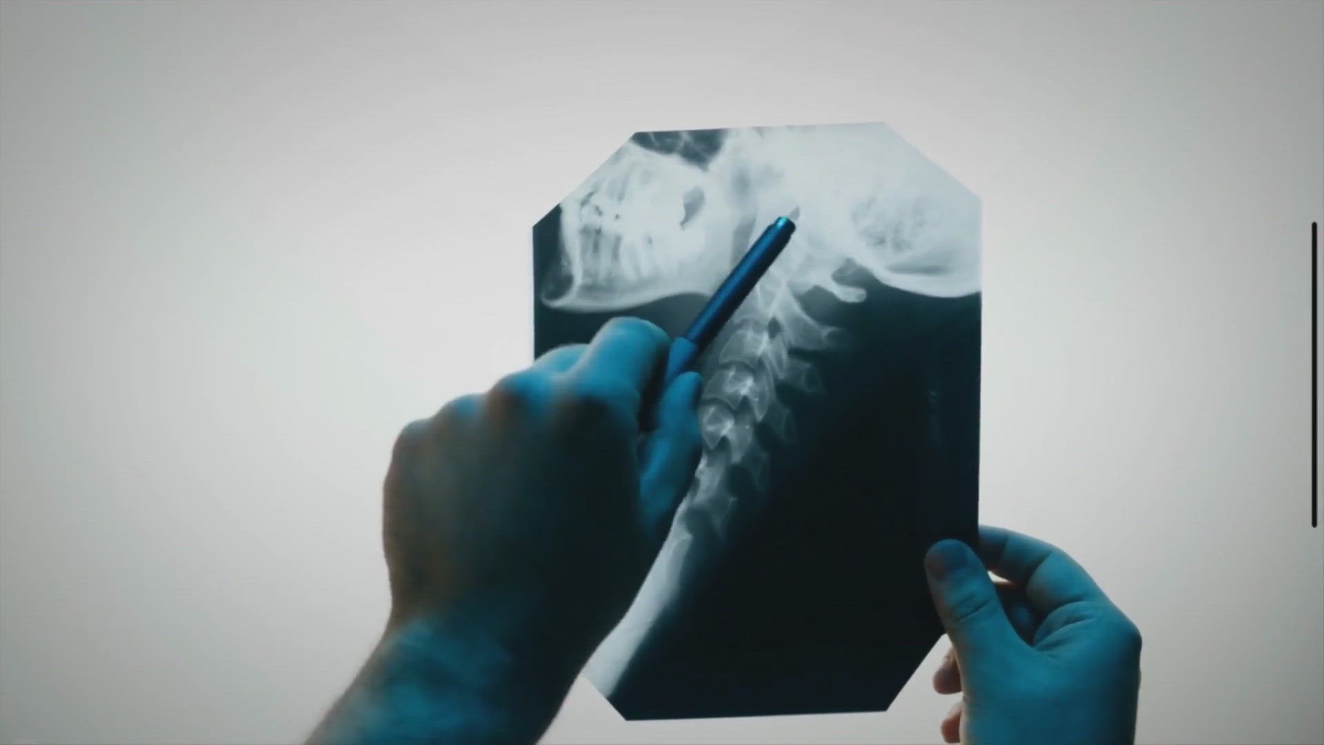 'Video thumbnail for Rectitude du rachis cervical : Que faire ? (Explications)'