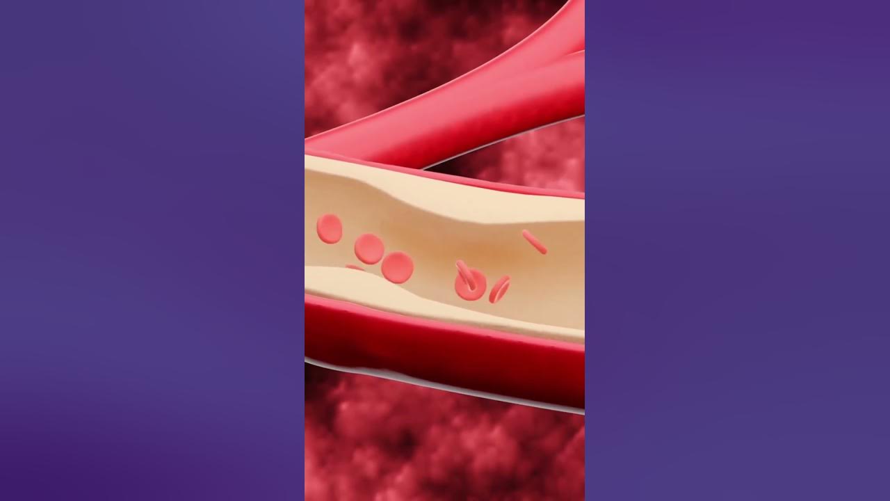 'Video thumbnail for Is Garlic Good for Your Heart? #shorts'