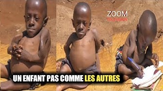 Video thumbnail for ALPHONSE : UN ENFANT PAS COMME LES AUTRES : HISTOIRE CHOQUANTE 😭😭😭