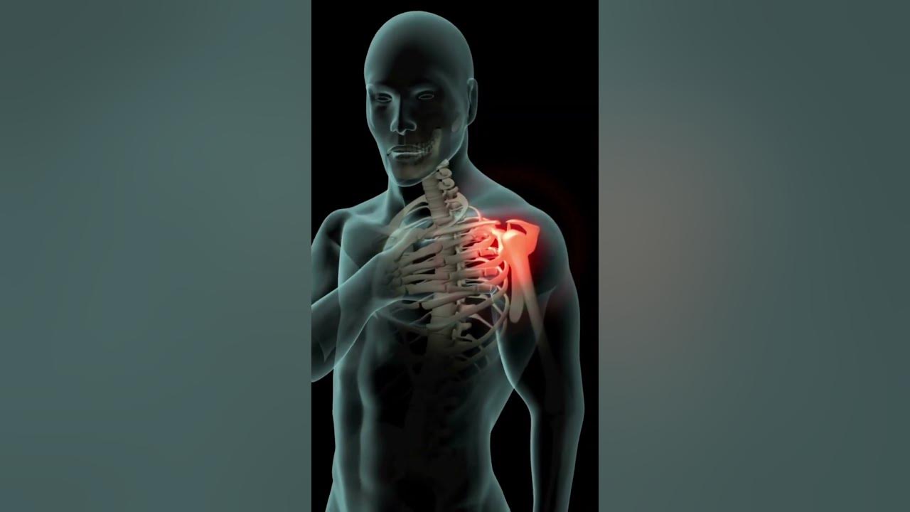 'Video thumbnail for Can Cayenne Relieve Pain? #shorts'