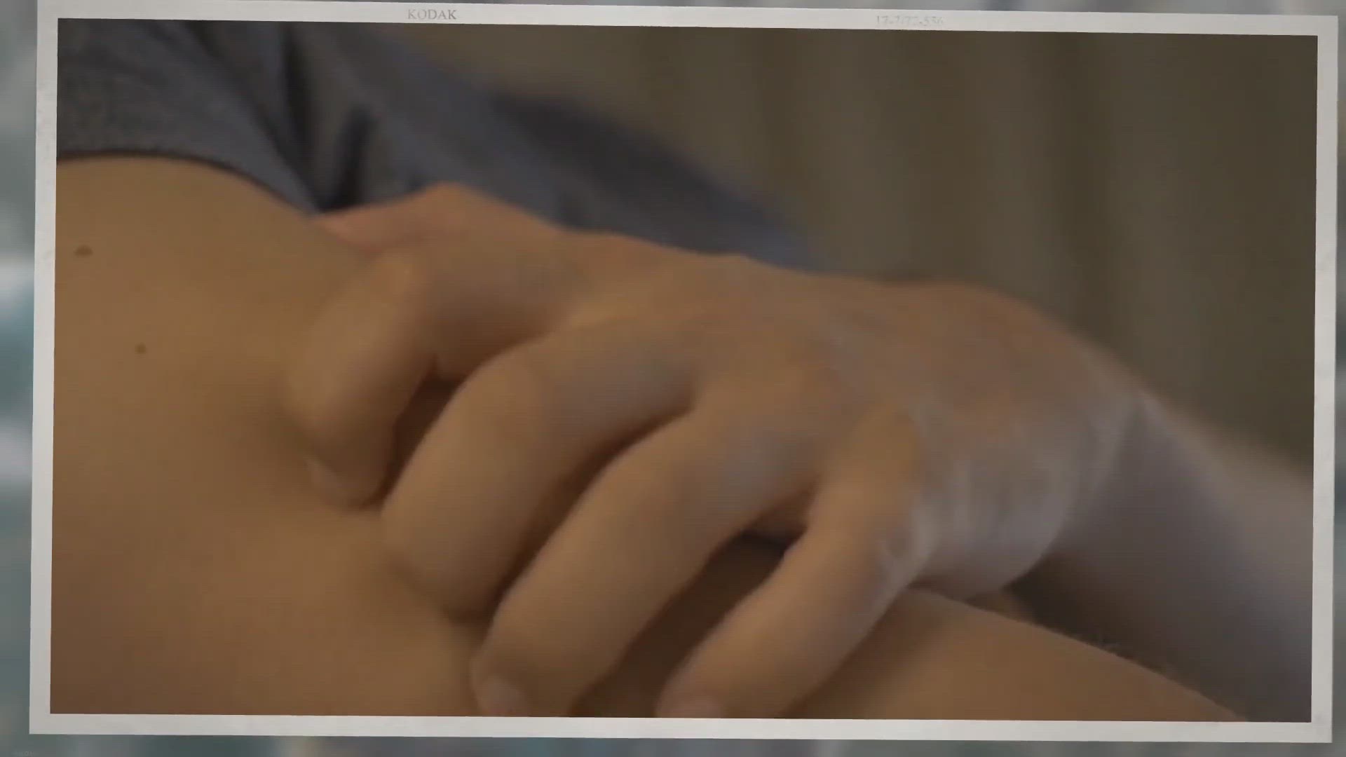 Video thumbnail for Different types of lipitor rash