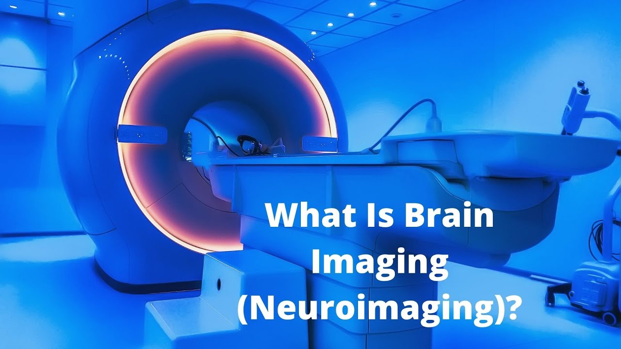 'Video thumbnail for What Is Brain Imaging (Neuroimaging)?'