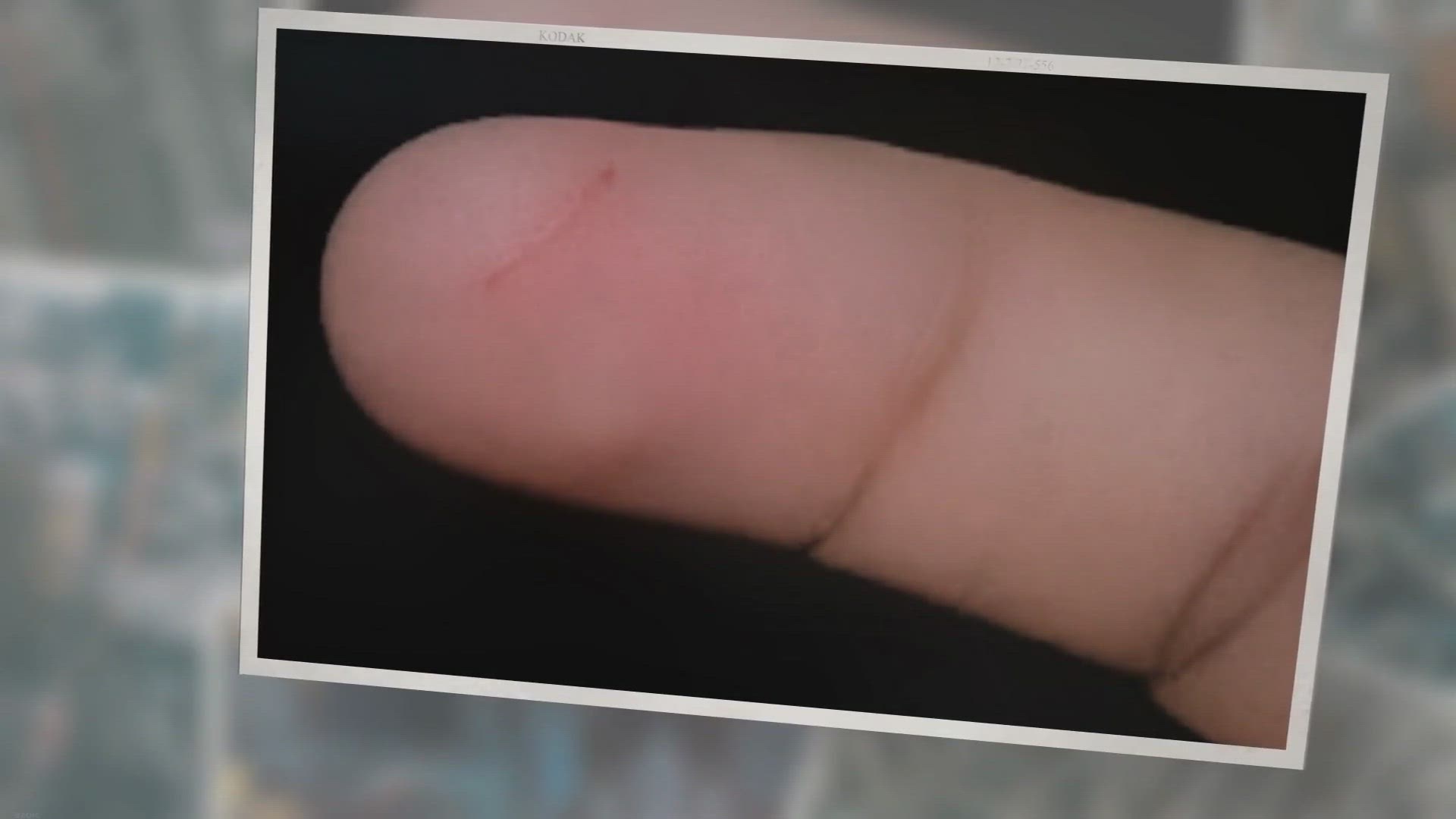 Video thumbnail for How to Treat a Paper Cut, and How Long Before They Heal?