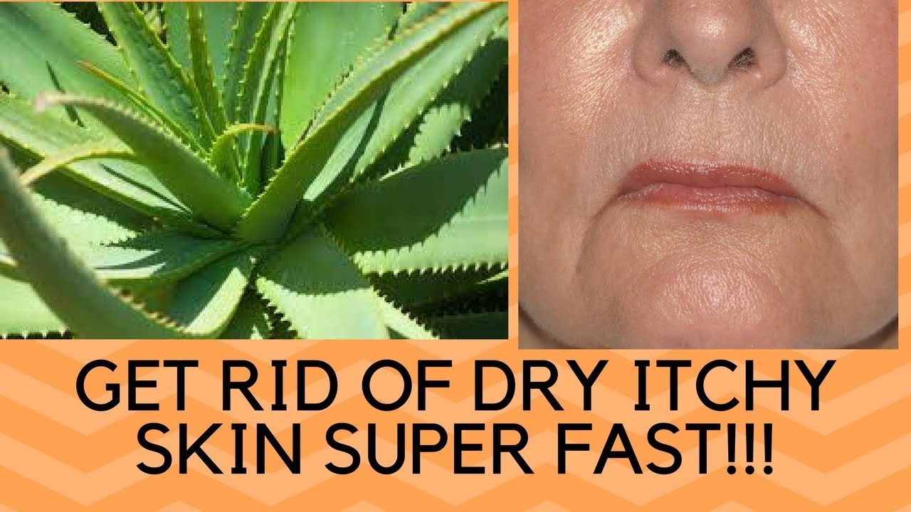 Video thumbnail for How To Get Rid Of Dry Skin On Face , Hands And Legs Overnight -  Home Remedies For Peeling Skin