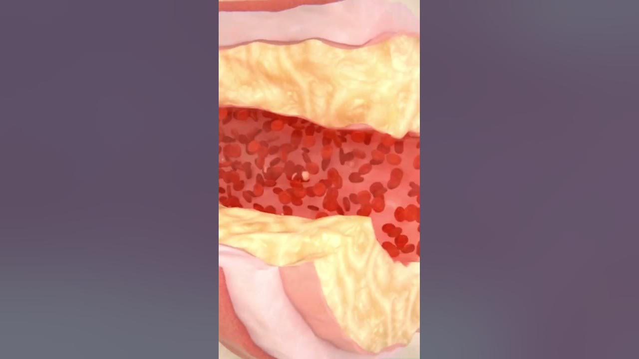 'Video thumbnail for Best 3 Healthiest Vinegars for Salad Dressing #shorts'