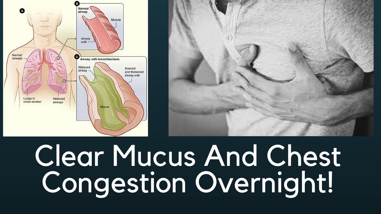 Video thumbnail for HOW TO CLEAR CHEST CONGESTION FAST  -  GET RID OF MUCUS IN THE THROAT NATURALLY