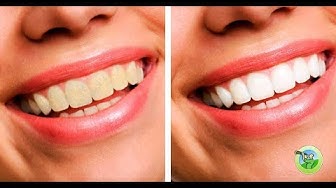 Video thumbnail for 10 Natural Ways to Whiten Your Teeth and Prevent Gum Disease