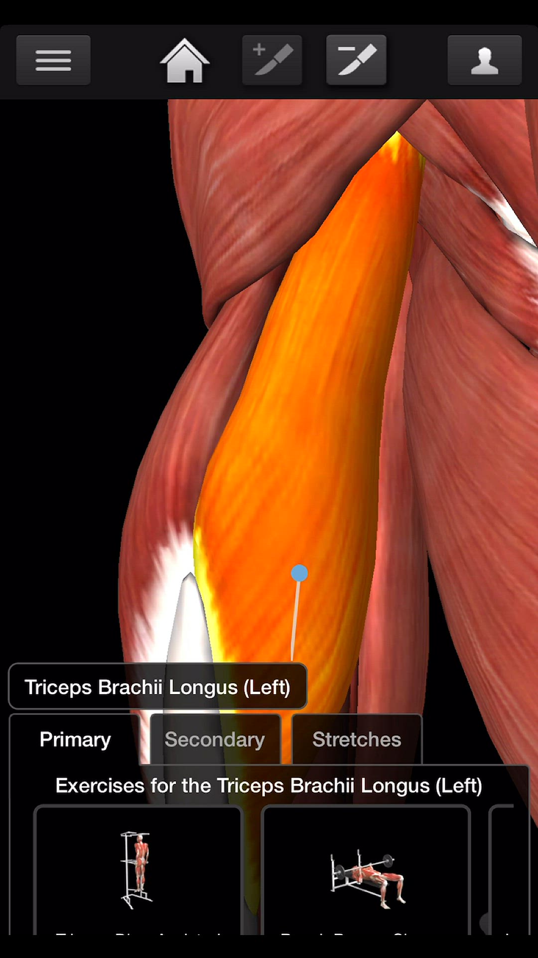 Video thumbnail for Bodybuilding - Triceps Barchii Workouts