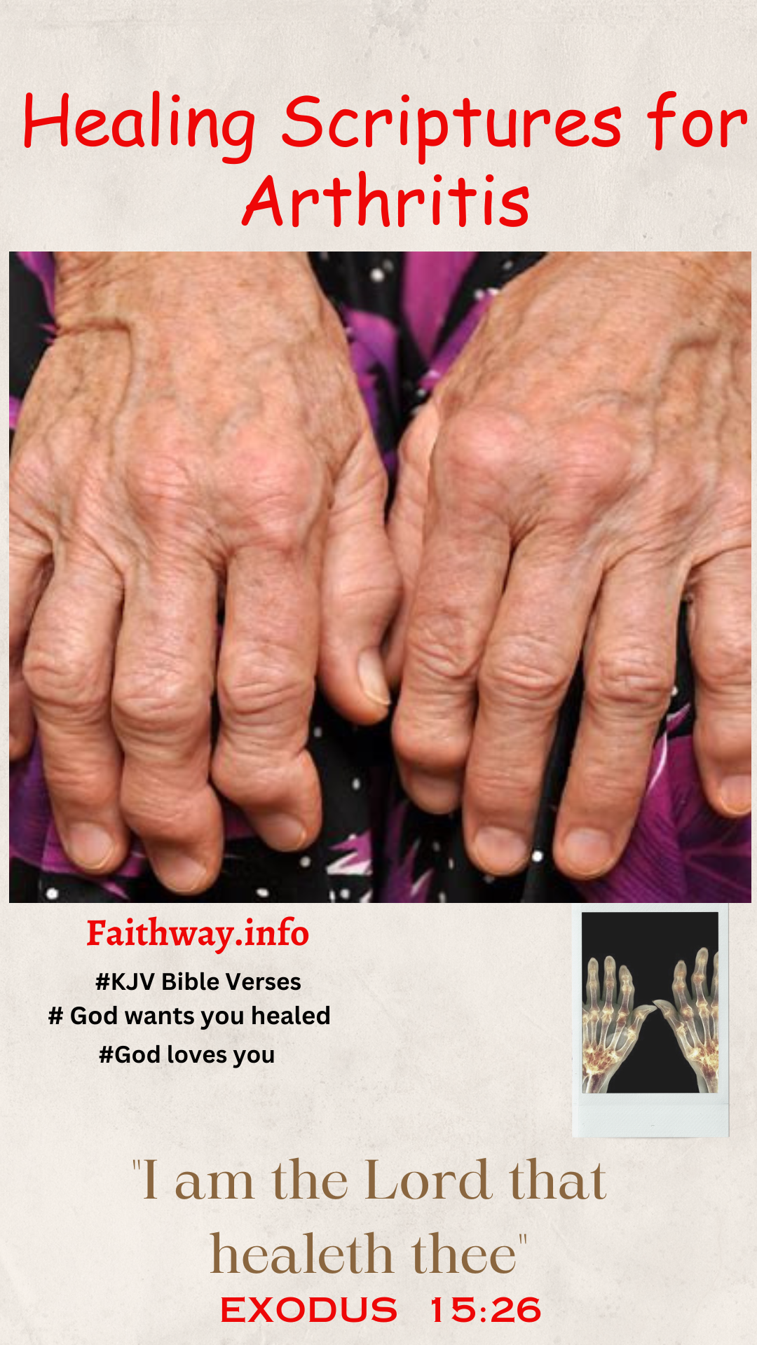'Video thumbnail for 22 Healing Scriptures for Arthritis: Finding Comfort and Strength'