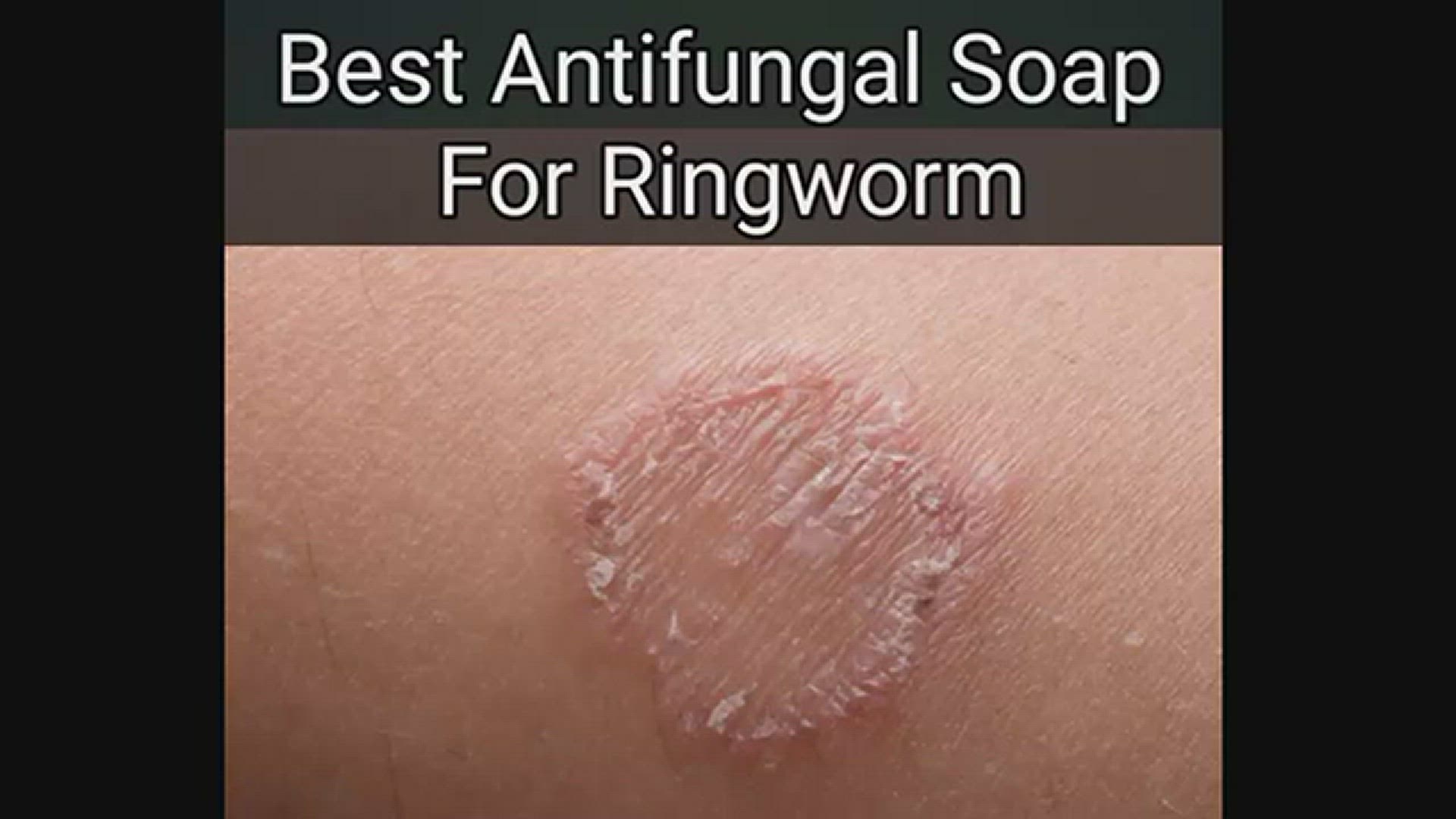 Video thumbnail for Best Antifungal Soap For Ringworm