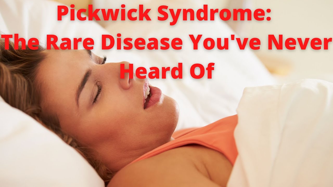 'Video thumbnail for Pickwick Syndrome the Rare Disease You Have Never Heard Of'