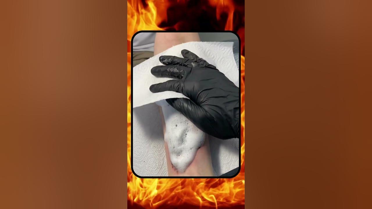 Video thumbnail for Vasto Lorde Ichigo From Bleach Anime Tattoo Art | Scar Cover-Up Ideas | #Shorts