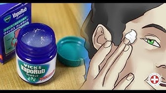 Video thumbnail for I Never Would Have Imagined That VapoRub Could Be Used Like This