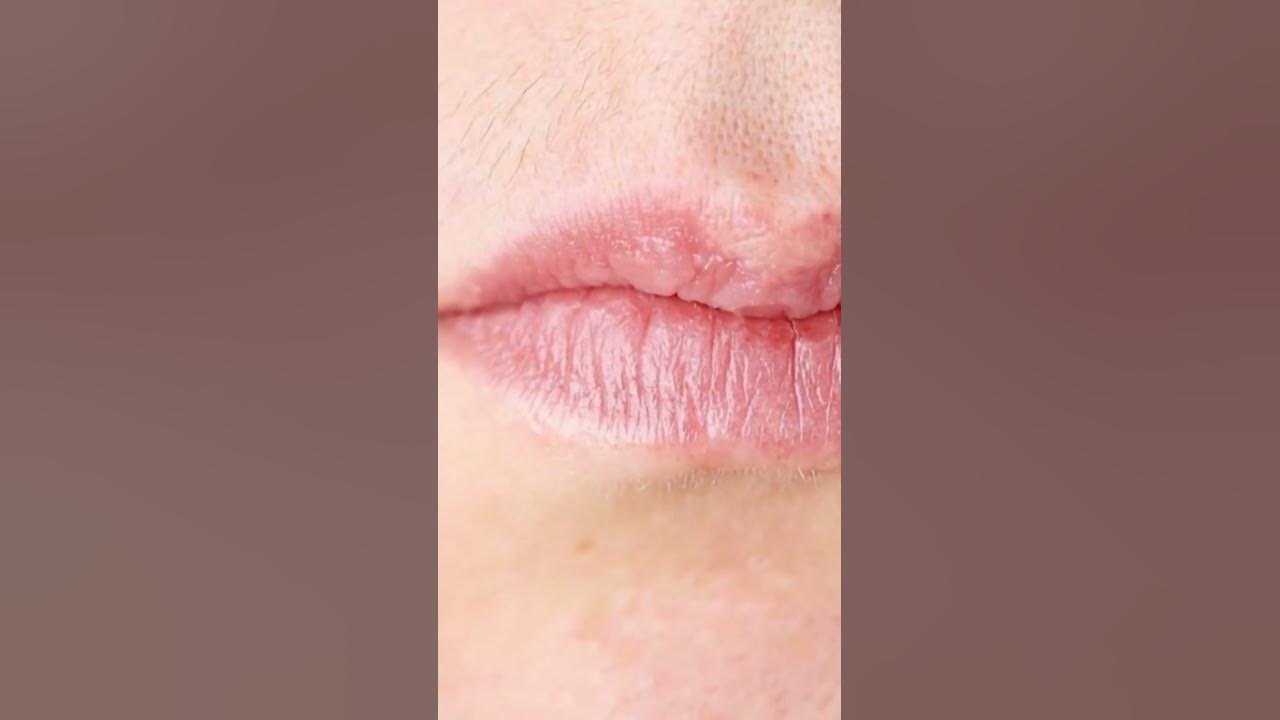 'Video thumbnail for PCOS and Hirsutism: What You Need to Know #shorts'