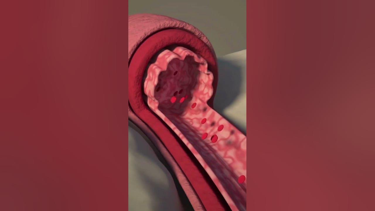 'Video thumbnail for Get Cracking: The Amazing Cardiovascular Benefits of Walnuts #shorts'