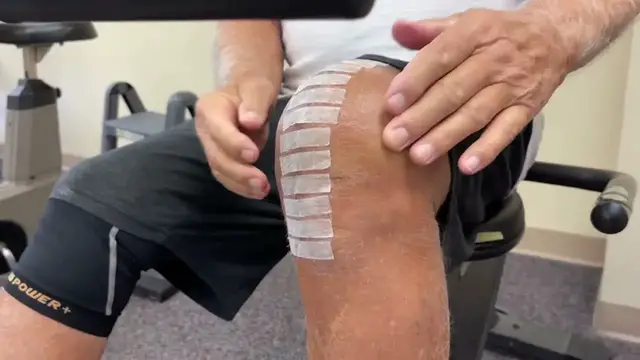 'Video thumbnail for 15-Days After a total knee replacement Day 1 of outpatient physical therapy. AMAZING!!! Part 1'
