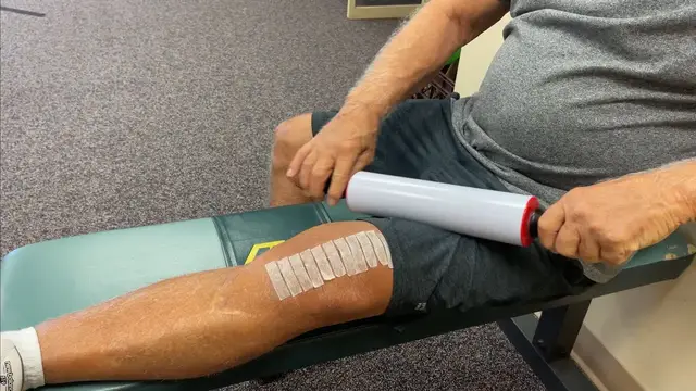 'Video thumbnail for 17-Days Post Op Update (Total Knee Replacement) Part 2'