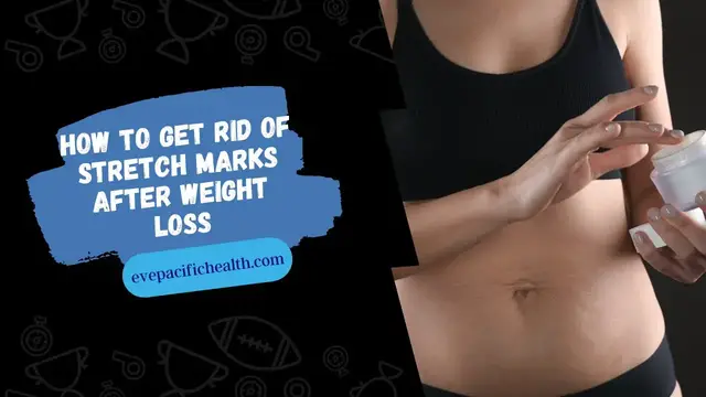 'Video thumbnail for How to Get Rid of Stretch Marks After Weight Loss #shorts#StretchMarks #evepacifichealth'