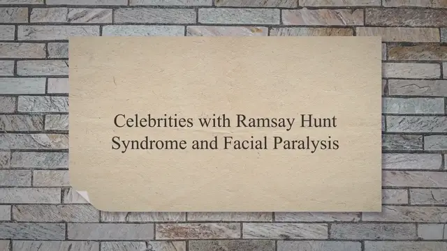 'Video thumbnail for Celebrities with Ramsay Hunt Syndrome and Facial Paralysis'