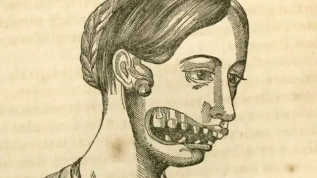 'Video thumbnail for The Messed Up Truth About The Radium Girls'