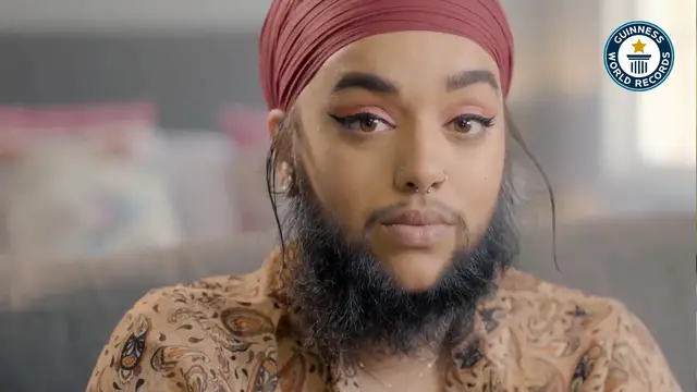 'Video thumbnail for  Embracing uniqueness, A bearded lady's perspective'