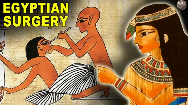 'Video thumbnail for What Surgery Was Like In Ancient Egypt'
