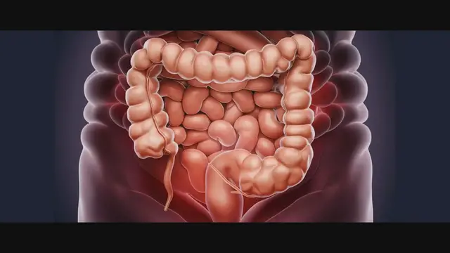 'Video thumbnail for Revitalize Your Colon: A Natural Detox Remedy'