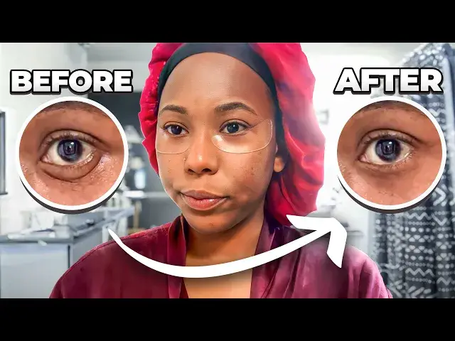 'Video thumbnail for My Before & After With Wrinkles Schminkles Under Eye Patches'
