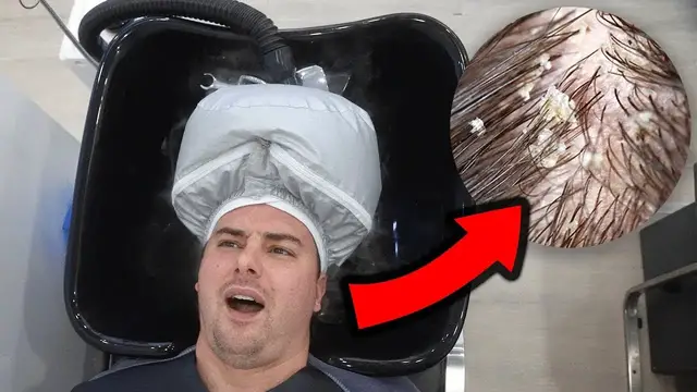 'Video thumbnail for I Got My Dirty Scalp DEEP CLEANED'