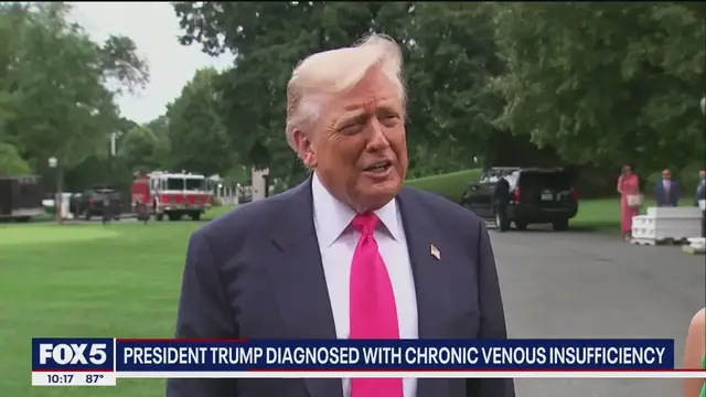 'Video thumbnail for Doctor explains Pres. Trump's vein condition diagnosis'