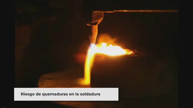 'Video thumbnail for Quemaduras por Soldadura en la Piel: Causas, Síntomas y Tratamiento'