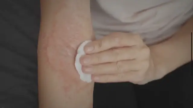 'Video thumbnail for Dermoia Shampoo Reviews - Is Dermoia Shampoo Legit Or Scam?'