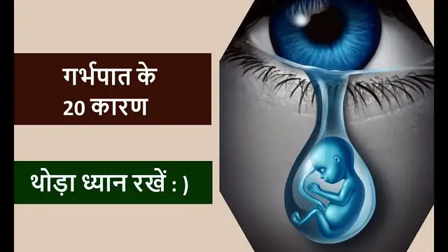 'Video thumbnail for प्रीमेच्योर डिलीवरी के 20 कारण'