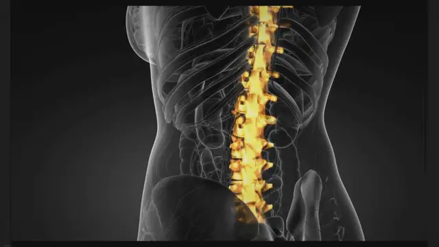 'Video thumbnail for Best Shoes For Scoliosis (3 TOP Tested Picks)'