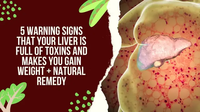'Video thumbnail for 5 Warning Signs That Your Liver Is Full of Toxins And Makes You Gain Weight + Natural Remedy'