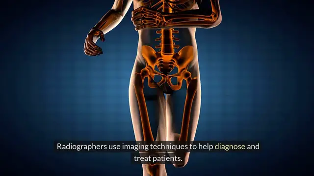 'Video thumbnail for Radiographer Vs Pharmacist'