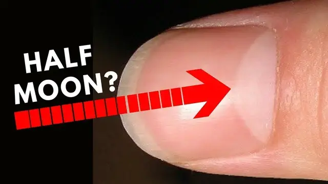 'Video thumbnail for Do You Have Half Moon Shape On Your Nails?? -Palmistry'