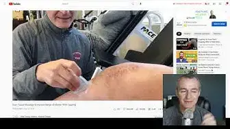 'Video thumbnail for Cupping for Scar Massage After Total Knee Replacement'