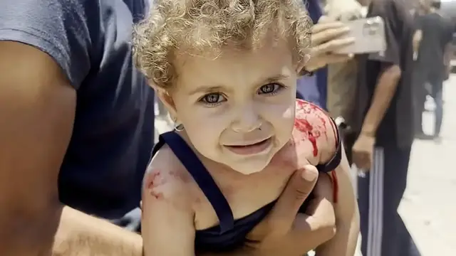 'Video thumbnail for More children need to be evacuated from Gaza for treatment: NGO'