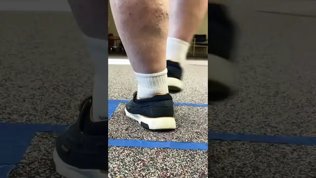 'Video thumbnail for New Knee Needs New Shoes'