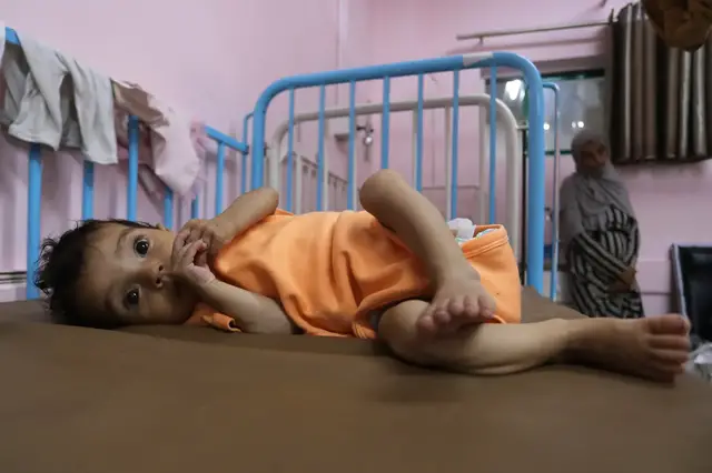 'Video thumbnail for Mass starvation taking hold in Gaza: Malnourished children overwhelming hospitals'