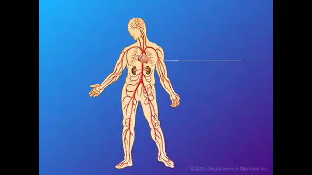 'Video thumbnail for How HIV Causes Disease'